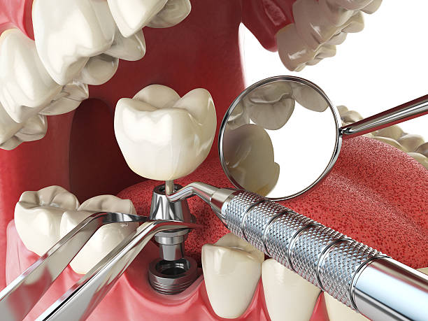 Best Emergency Dental Surgery in Evanston, IL